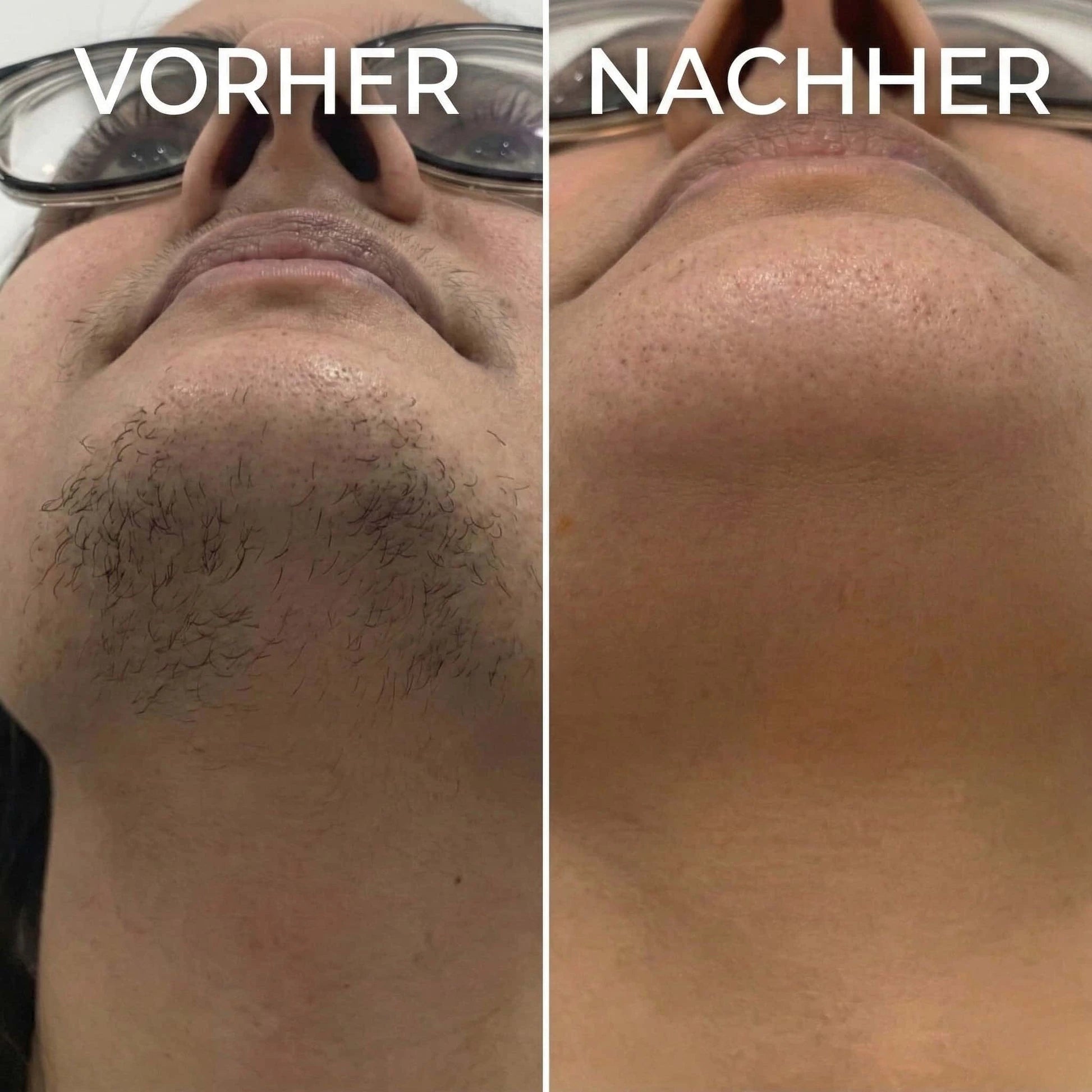 Violett – Pflanzlicher Haarwuchsstopp
