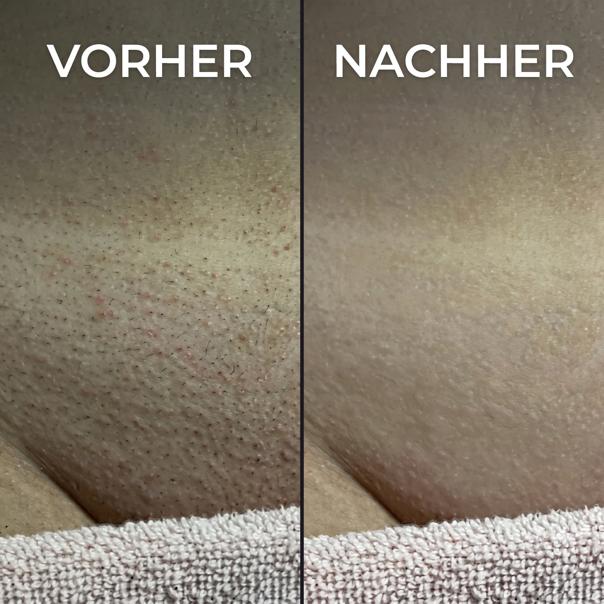Violett – Pflanzlicher Haarwuchsstopp