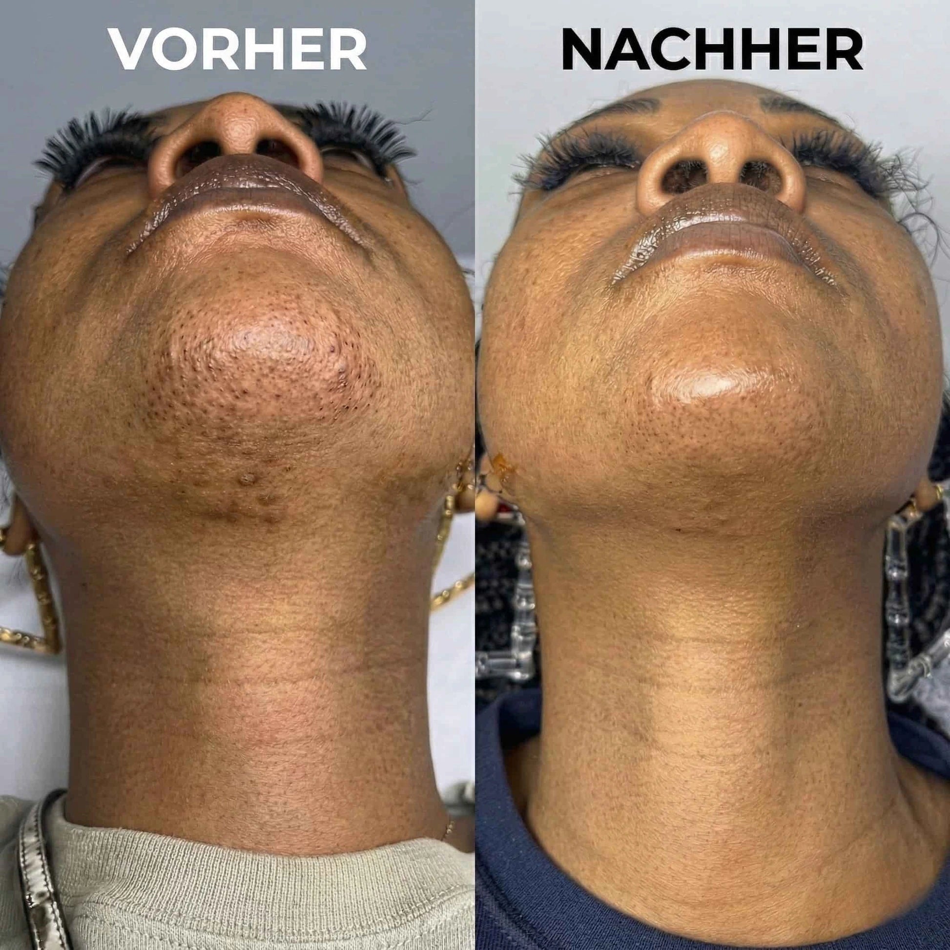 Violett – Pflanzlicher Haarwuchsstopp