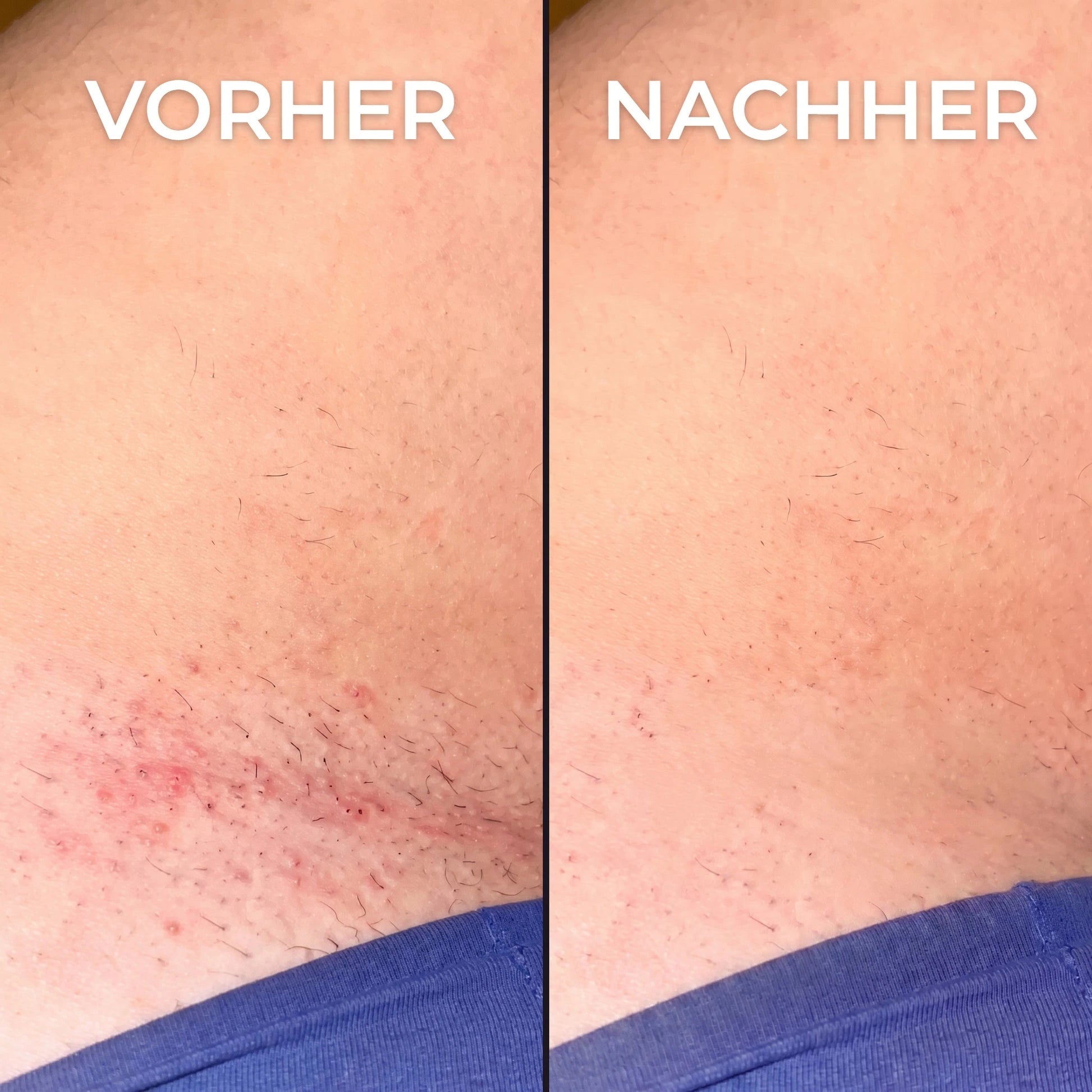 Violett – Pflanzlicher Haarwuchsstopp