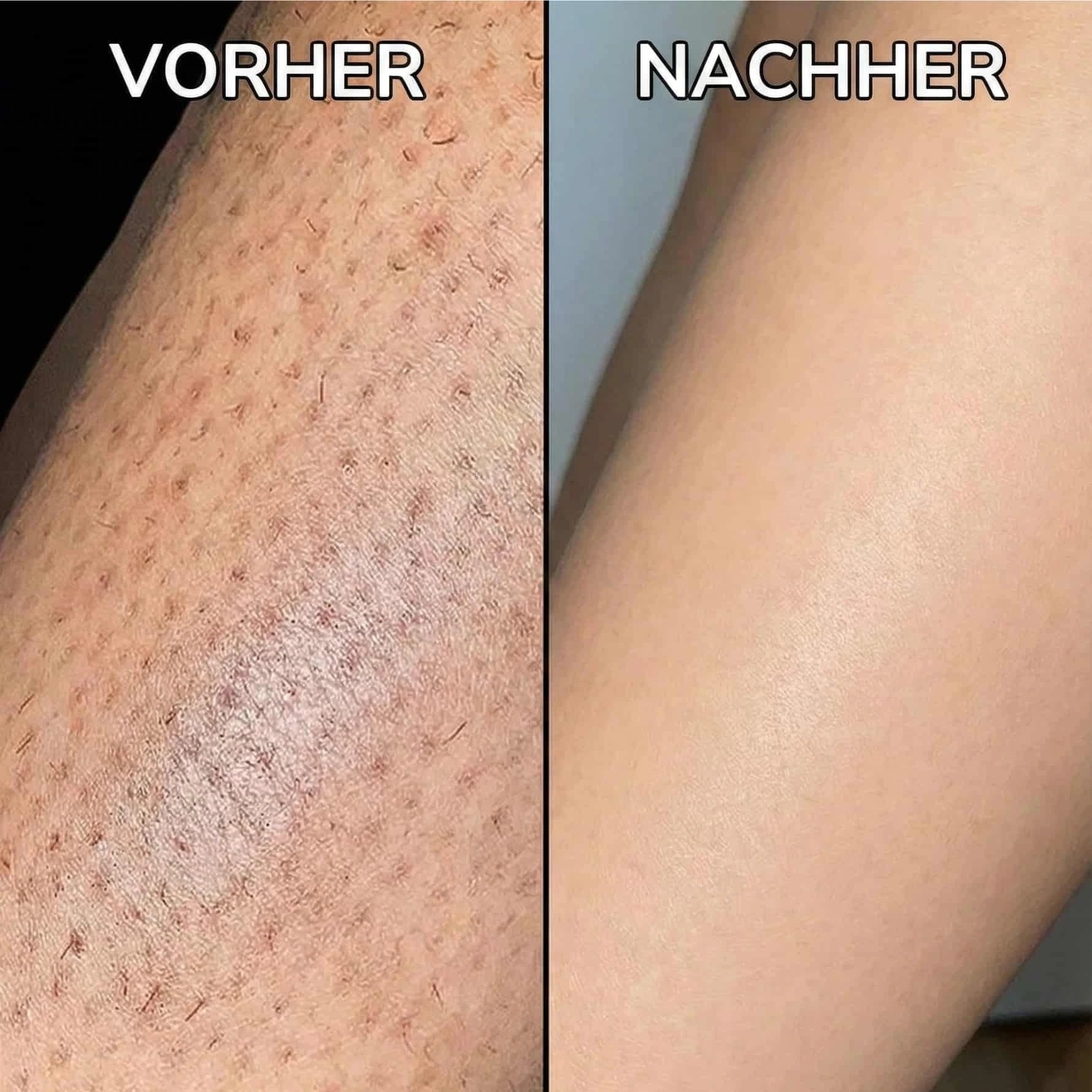 Violett – Pflanzlicher Haarwuchsstopp